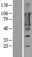 ERIC-1 / TACC3 Protein (Over-Expression Lysate Myc-DDK (Flag))