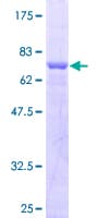 Human ESAM Protein (Recombinant GST)