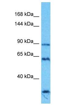 Polyclonal Rabbit anti-Human SPIDR / KIAA0146 Antibody (aa20-69, WB)