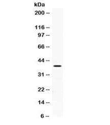 Polyclonal Rabbit anti-Human PON2 Antibody (WB)
