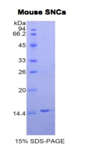 Mouse SNCA / Alpha-Synuclein Protein (Recombinant His)