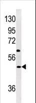 NPTX1 Antibody (aa174-203)