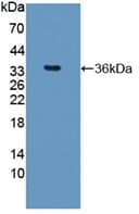 Human ARG1 / Arginase 1 Protein (Recombinant His, N-Terminal)