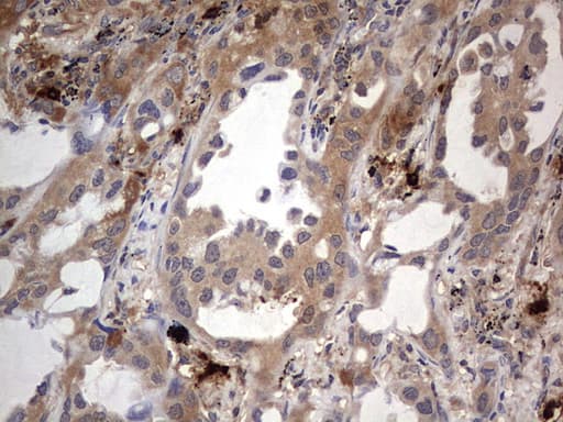 Monoclonal Mouse anti-Human SMPD1 / Acid Sphingomyelinase Antibody (clone OTI3H7, aa62-341, IHC, WB)
