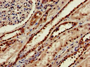 SEPX1 / Selenoprotein R Antibody