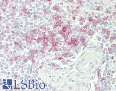 PathPlus™ Polyclonal Rabbit anti-Human CD2 Antibody (aa25-209, IHC, IF)