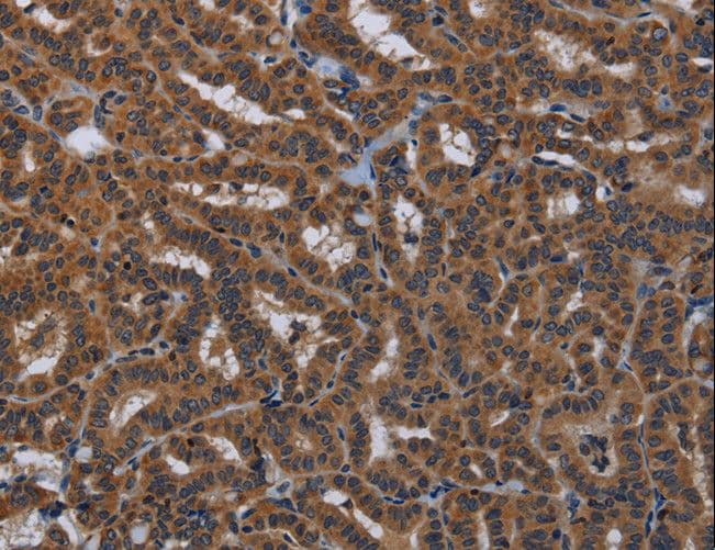Polyclonal Rabbit anti-Human KLK8 / Kallikrein 8 Antibody (IHC)