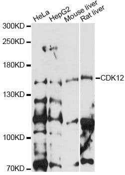 CDK12 / CRKRS Antibody
