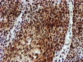 NQO2 Antibody (clone OTI3G4)