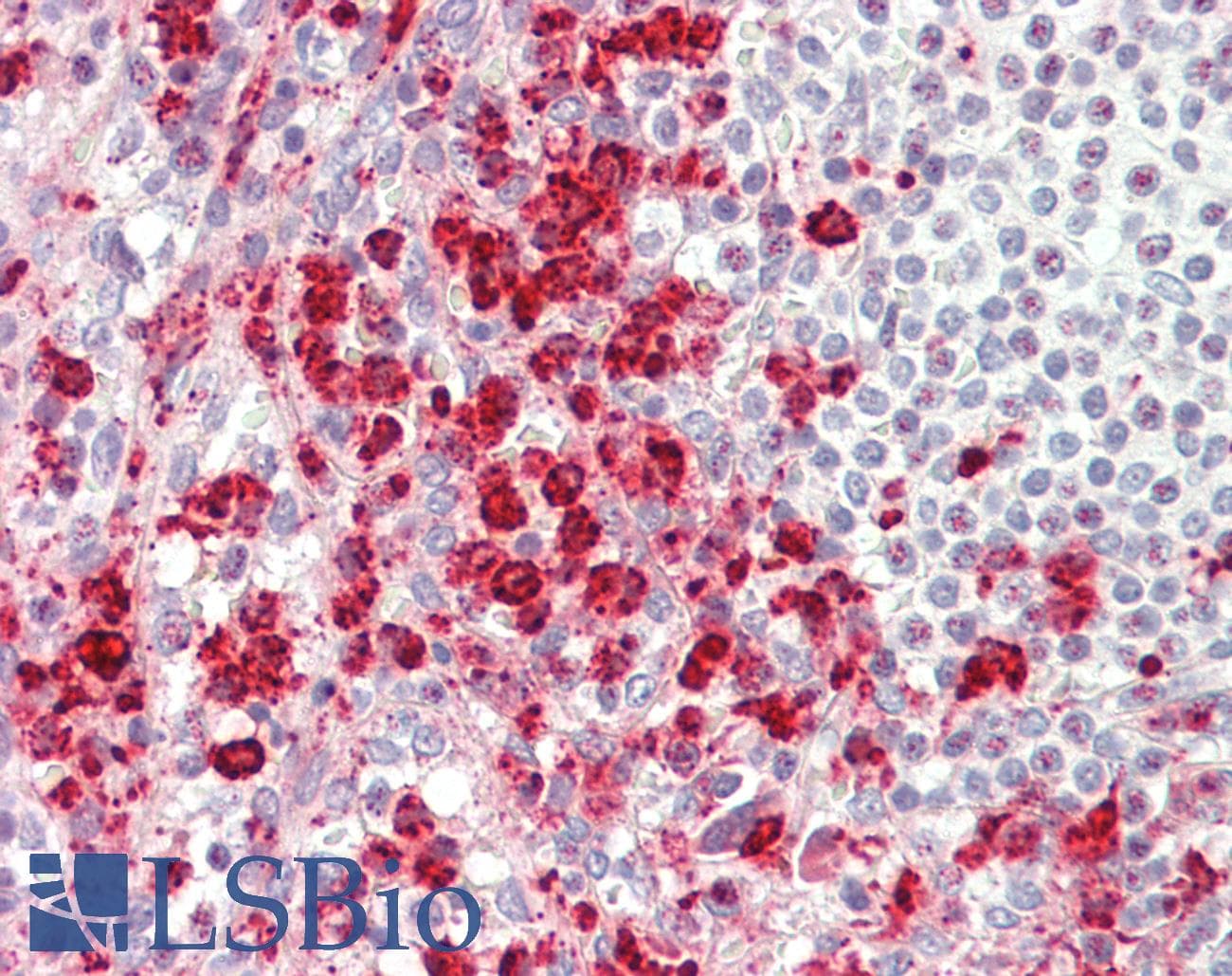 IHC-plus™ TRAM1 Antibody (aa310-374)