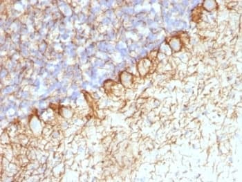 Neurofilament Antibody (clone RT-97 + NR-4)