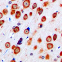 GRM5 / MGLUR5 Antibody (N-Terminus)