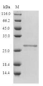 Human CD80 Protein (Recombinant 10His, N-terminus)