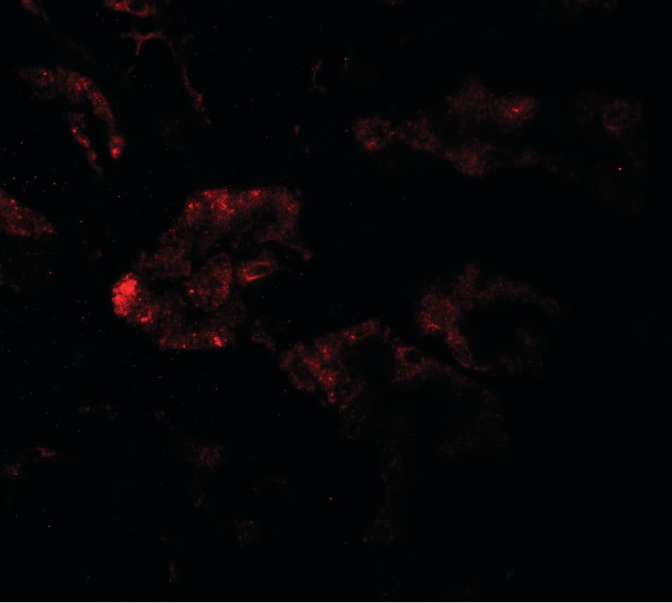 RAB21 Antibody