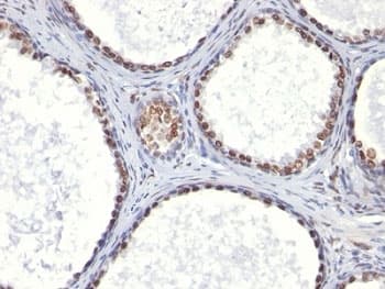 AR / Androgen Receptor Antibody (aa300-316, clone AR441)