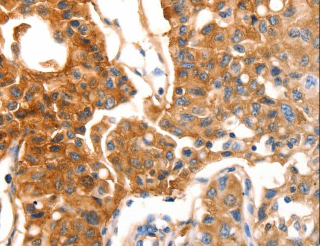 MVP / VAULT1 Antibody