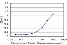 ANOS1 / Anosmin Antibody (clone 2E8)