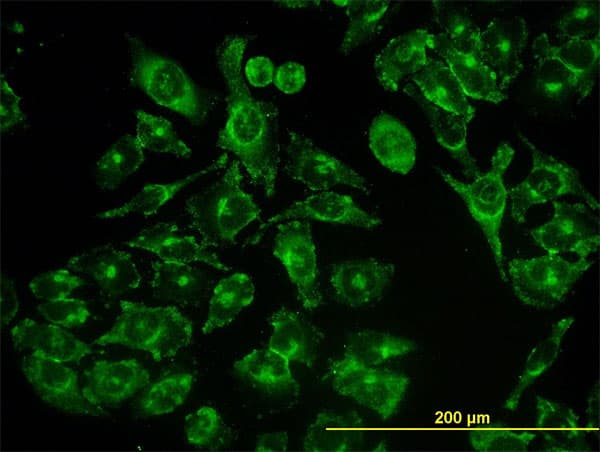 IHC-plus™ Monoclonal Mouse anti-Human GCP60 / ACBD3 Antibody (clone 2G2, IHC, IF, WB)