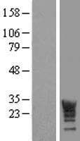 LRRC61 Protein (Over-Expression Lysate Myc-DDK (Flag))