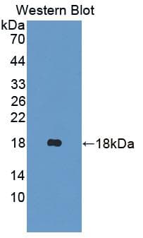 KRT1 / CK1 / Cytokeratin 1 Antibody (aa489-625, FITC)