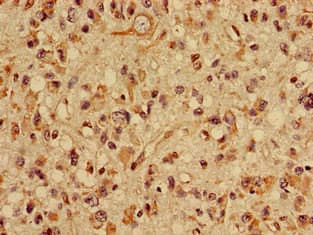 SLC22A2 Antibody
