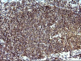SHBG Antibody (clone OTI1A6, Carrier-free)
