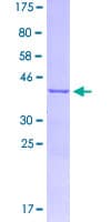 Human SCD1 / SCD Protein (Recombinant GST, N-terminus)