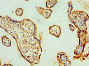 Polyclonal Rabbit anti-Human TFPI2 Antibody (aa23-235, IHC, WB)