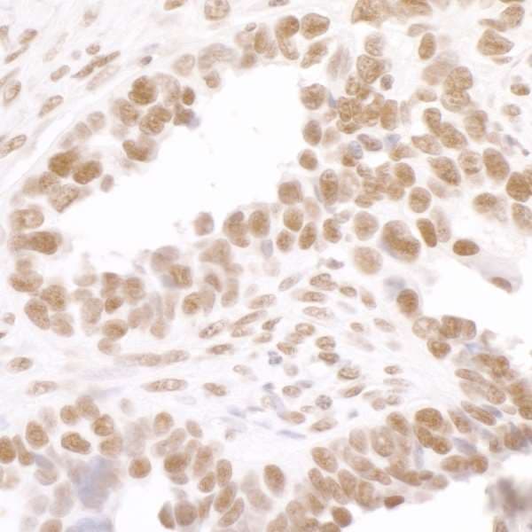 POLR2A / RNA polymerase II Antibody (phospho-Ser2)