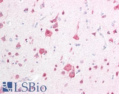 IHC-plus™ Polyclonal Rabbit anti-Human ELAVL4 / HuD Antibody (IHC, IF, WB)