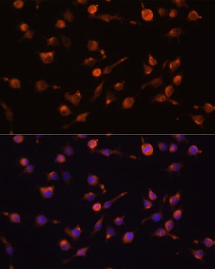 CD45 / LCA Antibody