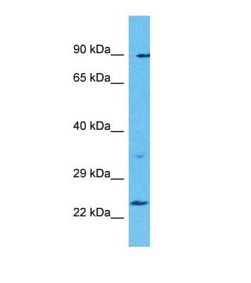 Polyclonal Rabbit anti-Human TBC1D28 Antibody (aa79-128, WB)