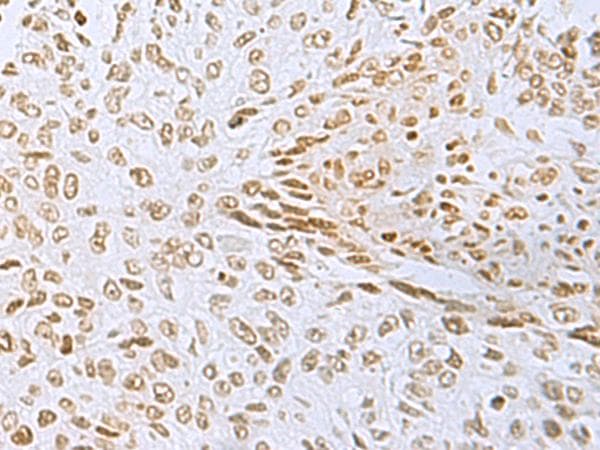 L3MBTL2 Antibody