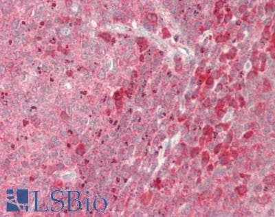 IHC-plus™ NTRK3 / TRKC Antibody