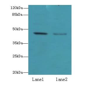 Polyclonal Rabbit anti-Human FAM46B Antibody (WB)