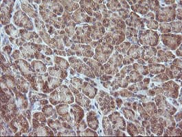 Monoclonal Mouse anti-Human MAP2K3 / MEK3 / MKK3 Antibody (clone OTI1H6, IHC, IF, WB)