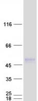 Human TMEM51 Protein (Recombinant Myc-DDK (Flag))