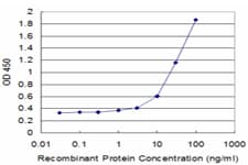 Monoclonal Mouse anti-Human SORL1 Antibody (clone 3F2, WB)