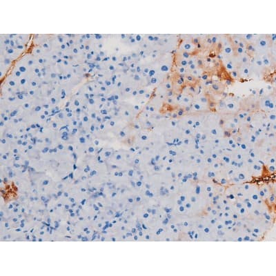 IRS1 Antibody (phospho-Ser639)