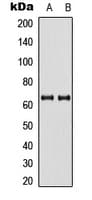 PAK3 Antibody (Internal)