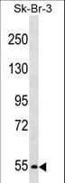 Polyclonal Rabbit anti-Human PCSK4 Antibody (aa168-196, WB)