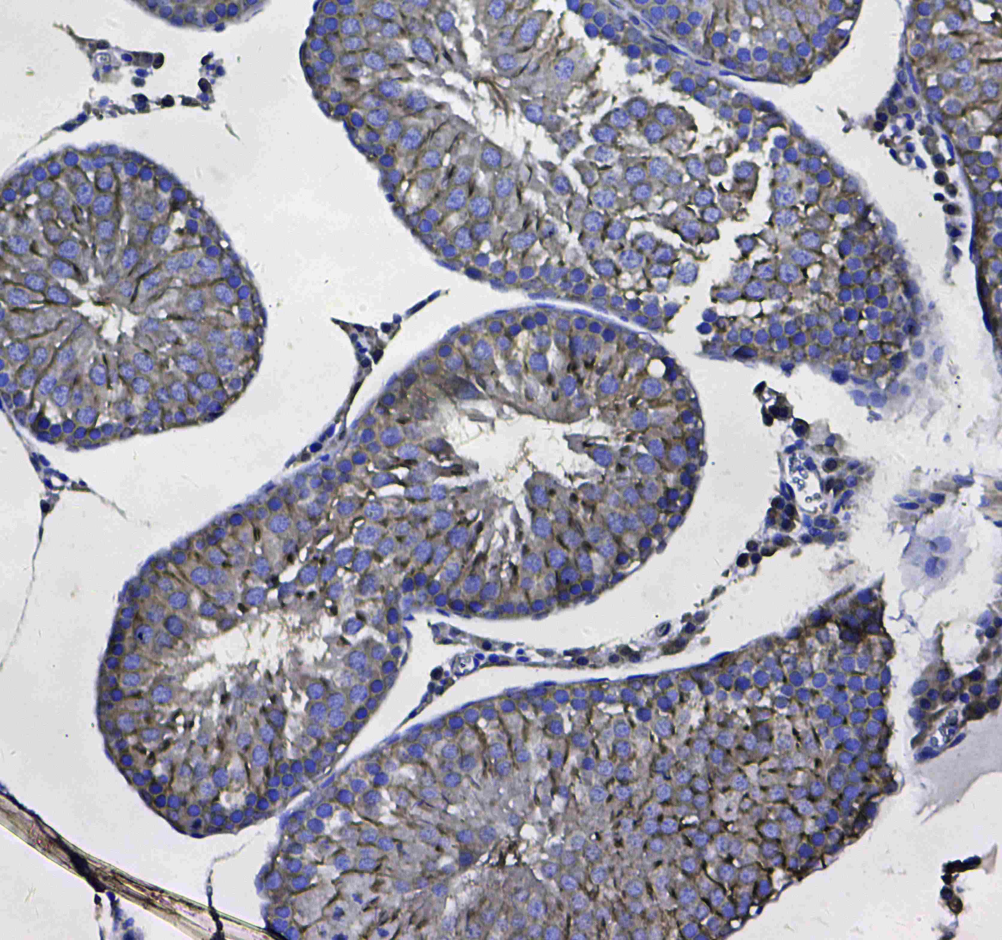 GSTM3 Antibody
