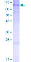 Human EMC1 Protein (Recombinant GST)