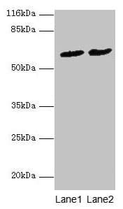Polyclonal Rabbit anti-Human PDZD3 Antibody (IHC, WB)