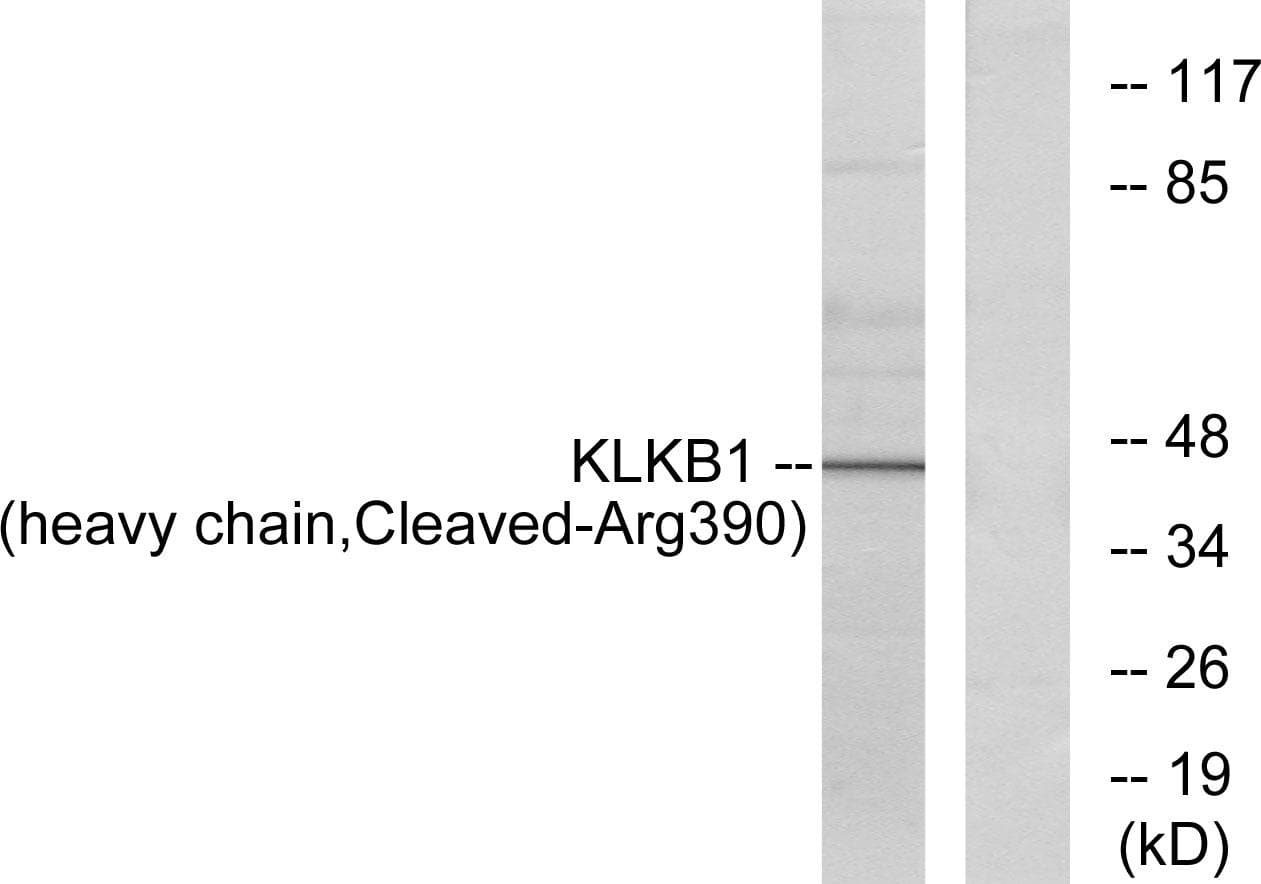 KLKB1 / Plasma Kallikrein Antibody (heavy chain, Cleaved-Arg390)