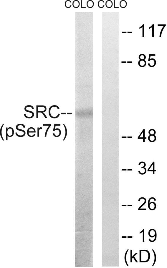SRC Antibody (phospho-Ser75)