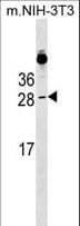 Polyclonal Rabbit anti-Human RAB39B Antibody (aa12-40, WB)