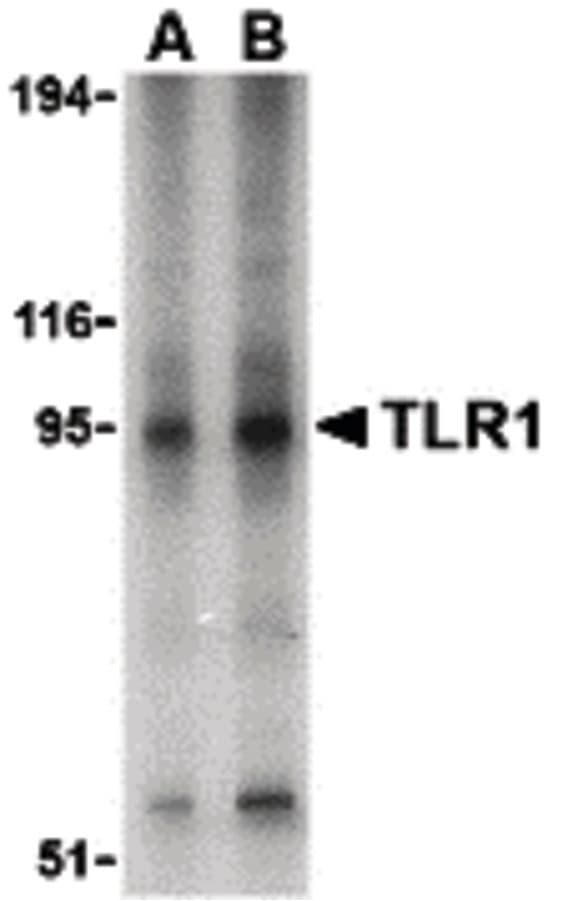 IHC-plus™ Polyclonal Rabbit anti-Human TLR1 Antibody (IHC, WB)