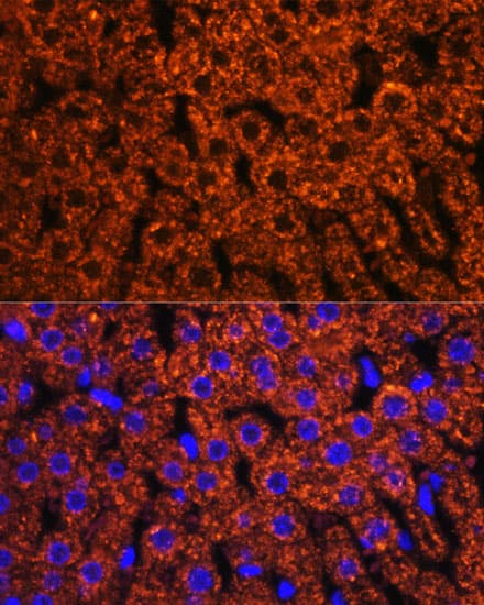 F2 / Prothrombin / Thrombin Antibody