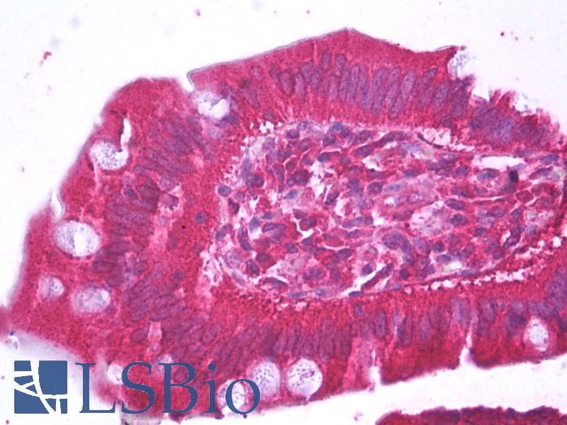 IHC-plus™ Monoclonal Mouse anti-Human HFE2 / Hemojuvelin Antibody (clone 1C12, IHC, WB)